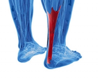 Potential Achilles Tendon Injuries