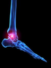 Common Symptoms That Are Associated With Rheumatoid Arthritis
